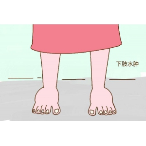 尿毒症脚肿怎么回事
