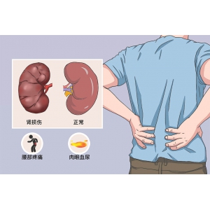 肾衰竭不治疗会有并发症吗