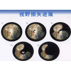 什么是视野