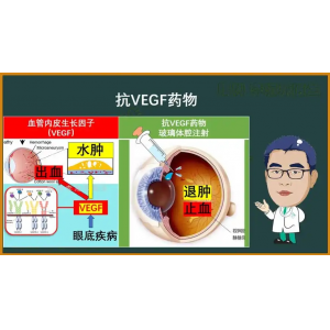 眼底病，这个“救星”要知道