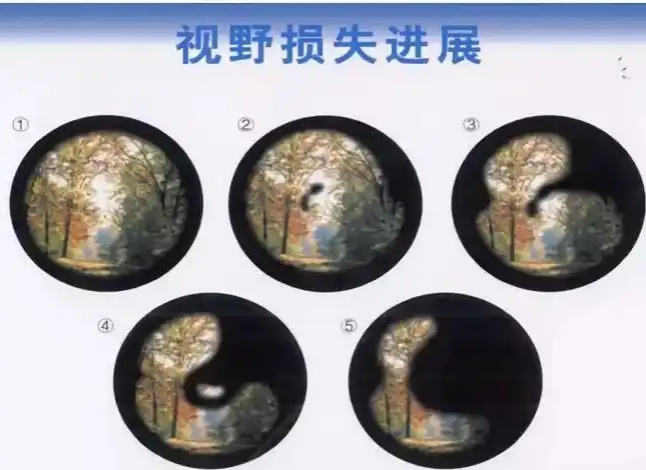 12-250R2094942100.png 12-250R2094942100.png